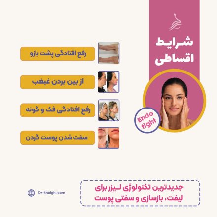 Endo Tight (اندوتایت)